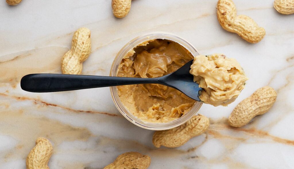 Peanuts and peanut butter are among the most common foods that trigger migraine